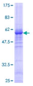 SDS-PAGE (WDR5-3719H).jpg